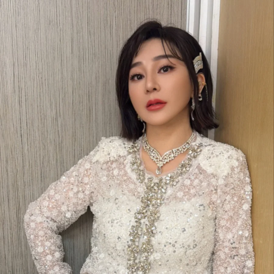 Quyết định làm đẹp thời trẻ khiến một nữ nghệ sĩ trả giá suốt 40 năm: Chiếc mũi biến dạng theo cách không ai ngờ - Ảnh 2.