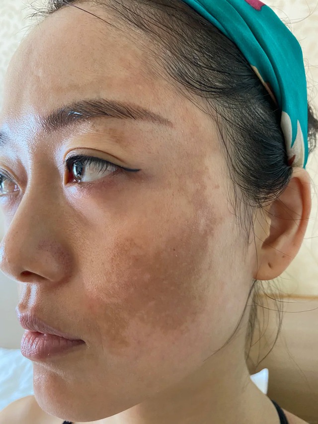 Phụ nữ ngoài 40 đang truyền nhau kiểu dưỡng da mặt nhìn căng bóng và ít chảy xệ hơn- Ảnh 1.
