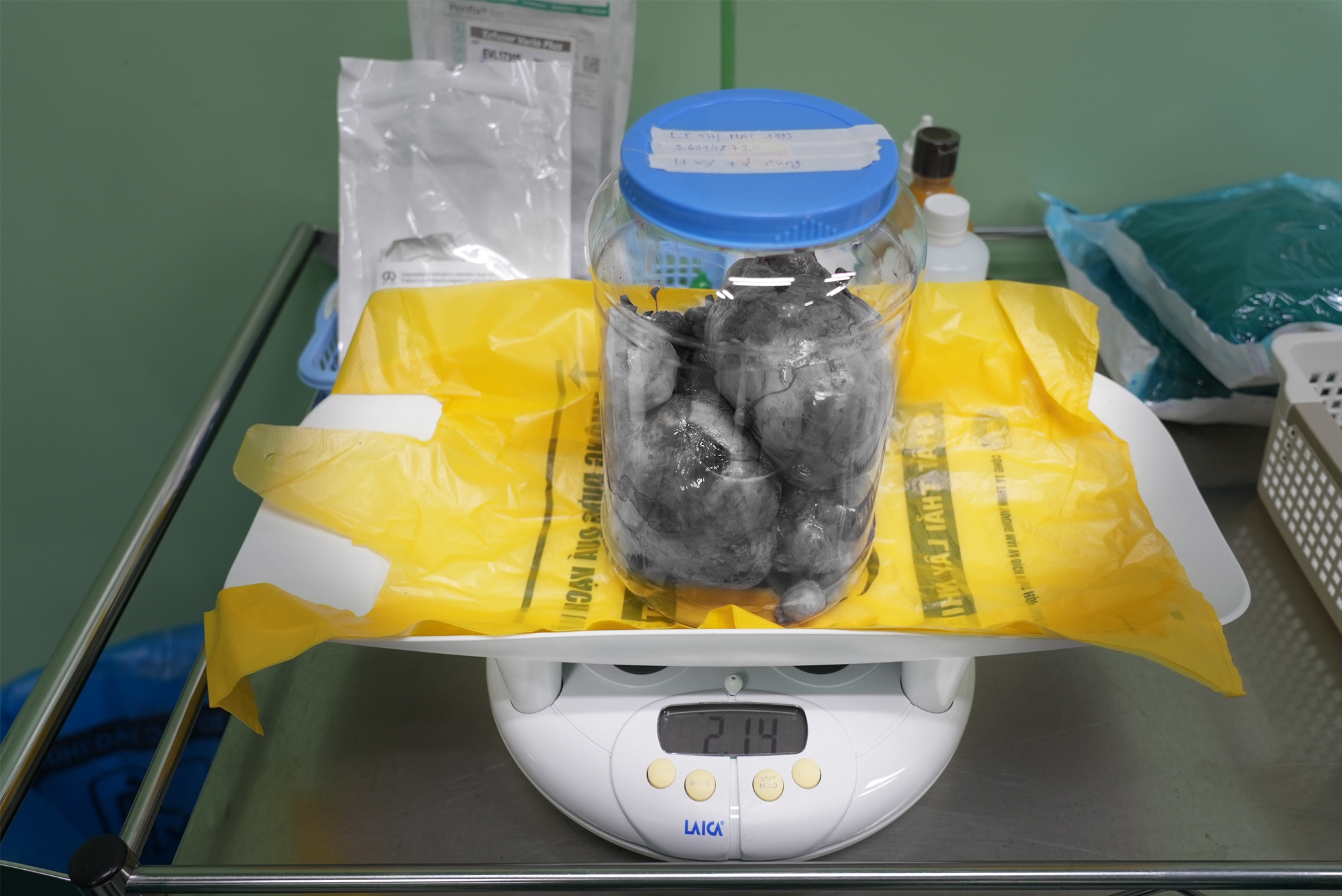 Ca mổ lấy thai đặc biệt: Đón bé 3,3kg chào đời và bóc tách thành công 9 khối u xơ tử cung - Ảnh 2.
