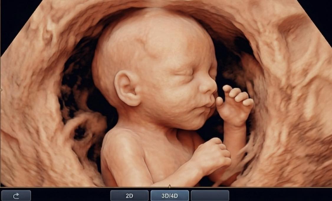 IVF có làm tăng tỷ lệ ung thư các loại? BS nam sản khoa tiết lộ sự thật - Ảnh 2.