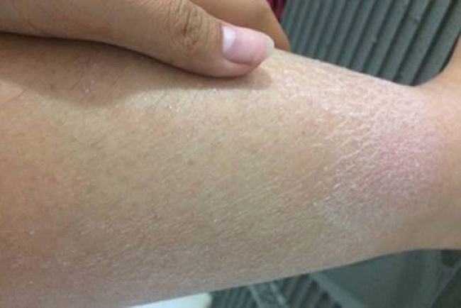 Các bác sĩ nói thẳng: Bắp chân là "đèn báo" đột quỵ, thấy 5 thứ phải đến bệnh viện ngay!- Ảnh 4.