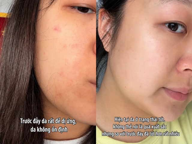 Không giúp đẹp sau một đêm, nhưng thói quen này khiến làn da của tôi ổn định hơn từng ngày- Ảnh 2.