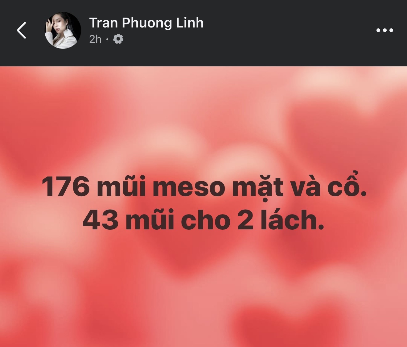 Nữ ca sĩ Việt 42 tuổi tự so mình với Song Hye Kyo, công khai 176 mũi tiêm trên mặt và 43 mũi ở vùng "khó nói"- Ảnh 2.