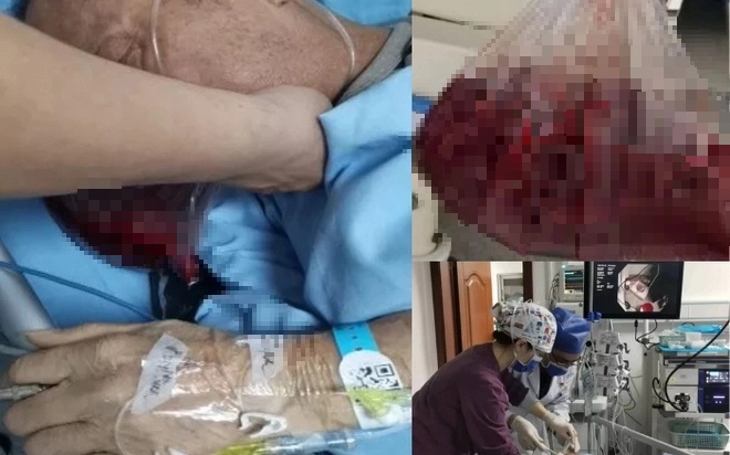 Sụt 15kg trong 2 tháng, nữ nhân viên văn phòng "tá hỏa" khi phát hiện liệt dạ dày do kiểu ăn uống càng trẻ càng dễ gặp - Ảnh 3.