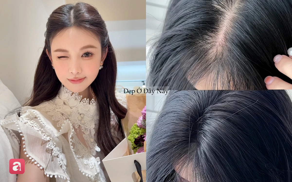 5 lọ dưỡng serum tóc "made in Vietnam" được nhiều chị em yêu thích vì giúp tóc mọc tua tủa, giảm rụng thấy rõ - Ảnh 1.