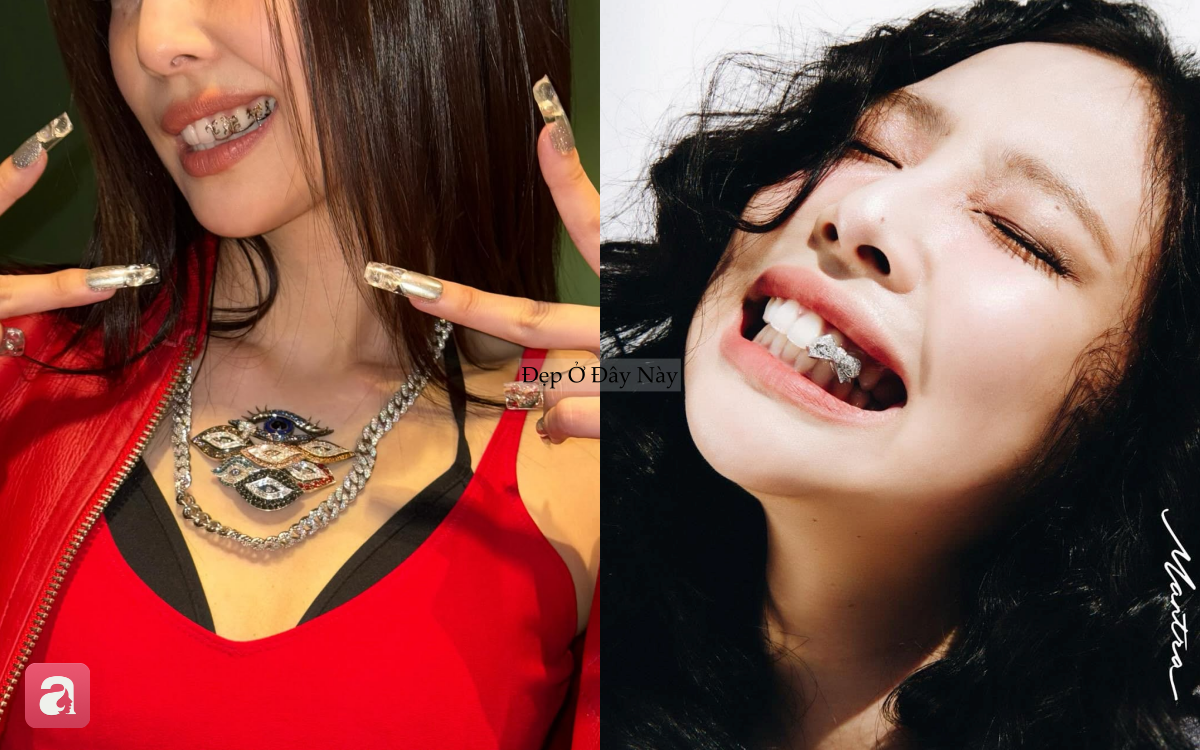 Chiếc bọc răng của Jennie có gì đặc biệt mà khiến fan chú ý hơn cả vòng cổ 1,2 tỷ đồng?- Ảnh 6.