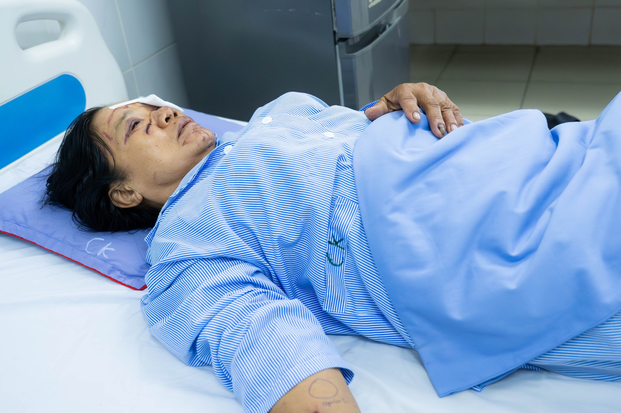 Gặp người phụ nữ bán rau bị xịt nước chảy máu mắt ở Phú Thọ: Gặp người phụ nữ bán rau bị xịt nước chảy máu mắt ở Phú Thọ: