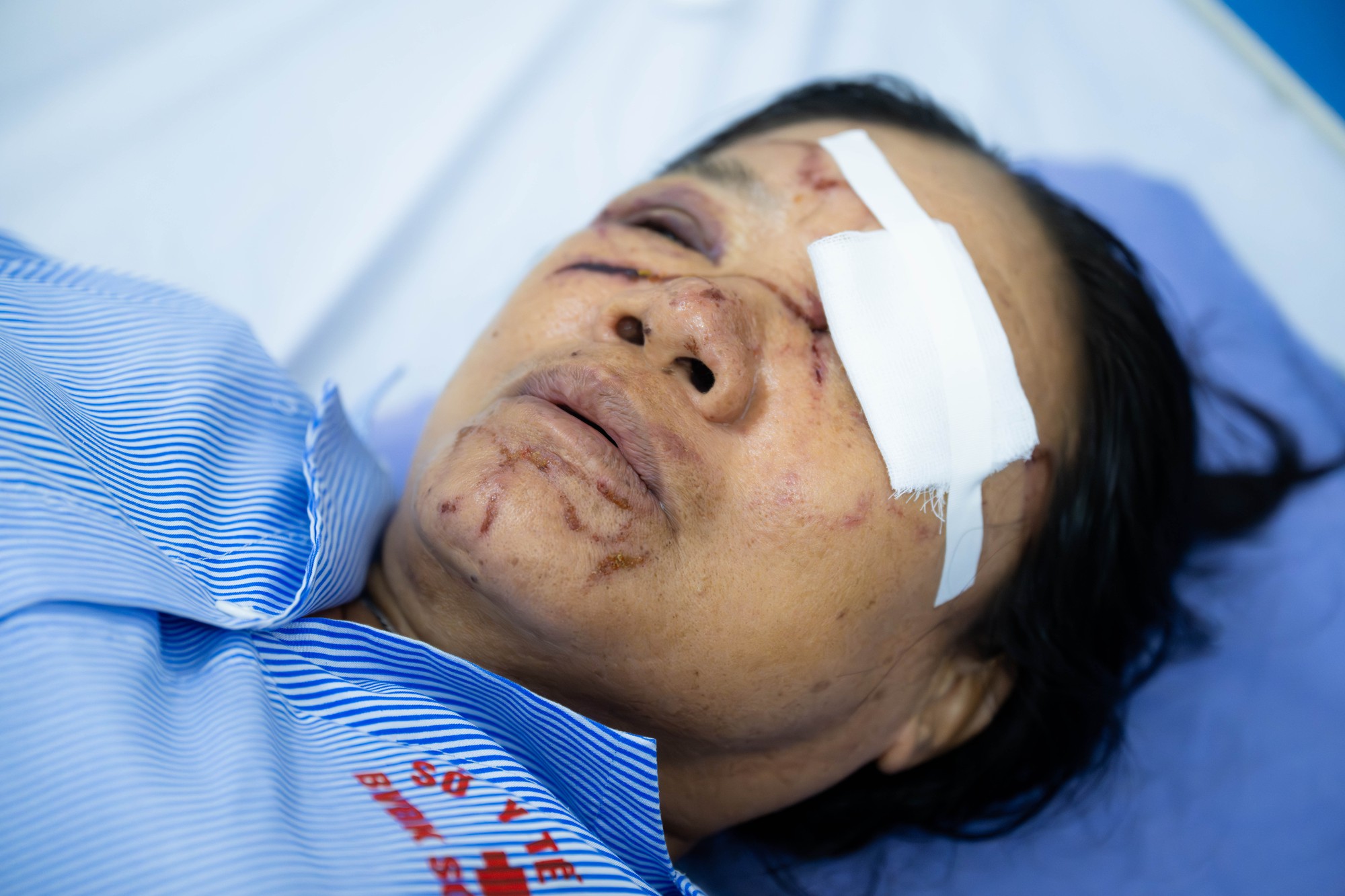 Gặp người phụ nữ bán rau bị xịt nước chảy máu mắt ở Phú Thọ: Gặp người phụ nữ bán rau bị xịt nước chảy máu mắt ở Phú Thọ: