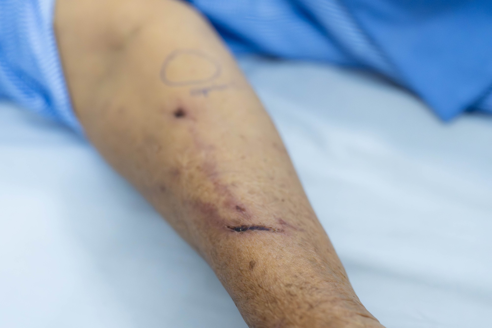 Gặp người phụ nữ bán rau bị xịt nước chảy máu mắt ở Phú Thọ: Gặp người phụ nữ bán rau bị xịt nước chảy máu mắt ở Phú Thọ: