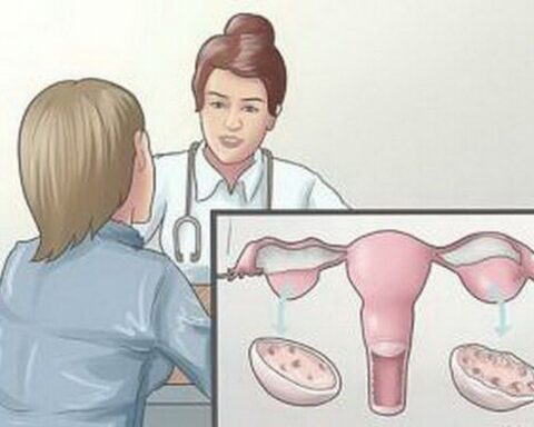 Cách phân biệt u nang buồng trứng lành tính và u nang bệnh lý