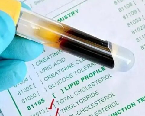 Mỡ máu từ 7,1 xuống còn 1,4 sau vài tháng: Người đàn ông 54 tuổi tiết lộ 3 thói quen bỏ càng sớm, mạch máu càng “dễ thở”