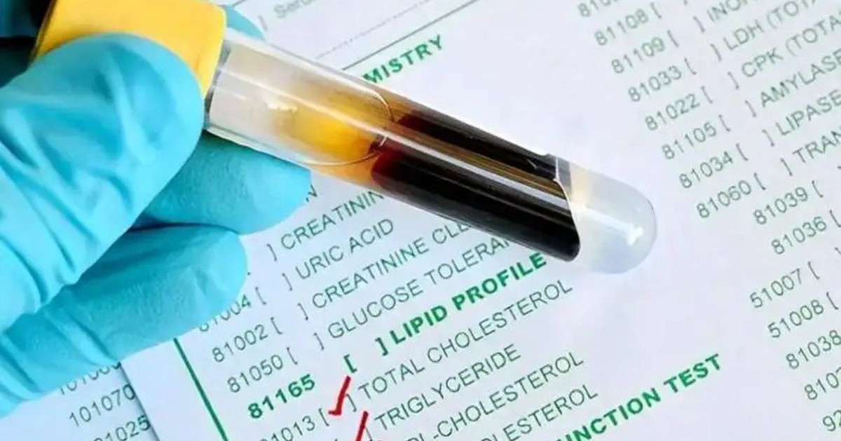 Mỡ máu từ 7,1 xuống còn 1,4 sau vài tháng: Người đàn ông 54 tuổi tiết lộ 3 thói quen bỏ càng sớm, mạch máu càng “dễ thở”