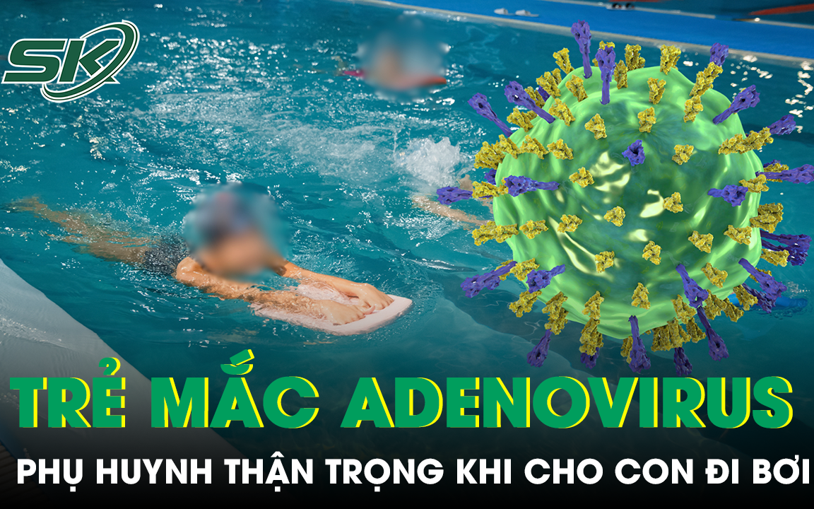 Trẻ mắc Adenovirus tăng gấp 3 năm ngoái, phụ huynh cần làm gì để phòng tránh cho con?