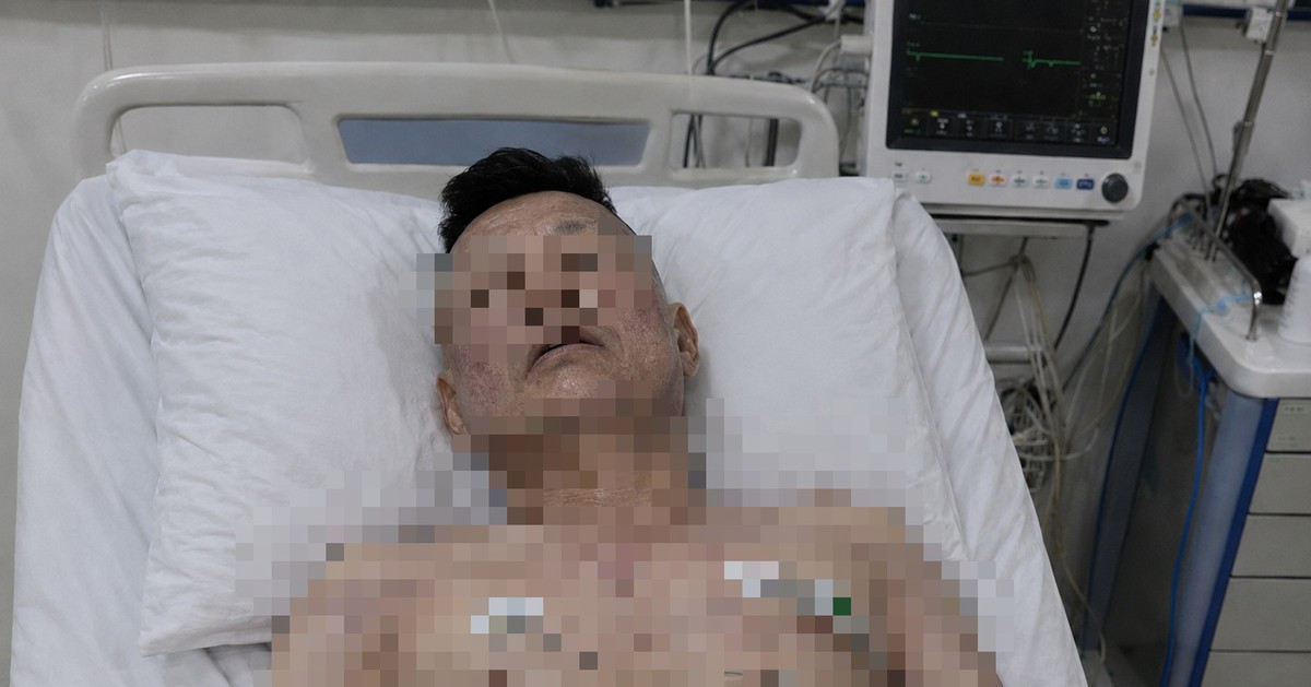 Người đàn ông 46 tuổi tử vong trên giường, bác sĩ cảnh báo loại đồ uống quen thuộc “vạn người mê”