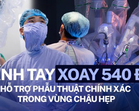 Bệnh viện K ứng dụng robot Da Vinci Xi trong điều trị ung thư trực tràng