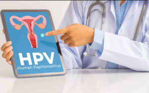 Vì sao cần sàng lọc ung thư cổ tử cung ở người nhiễm HIV?