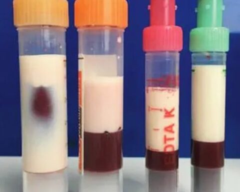 Bé trai 5 tuổi máu “trắng đục như sữa” vì thường xuyên ăn món canh quen thuộc
