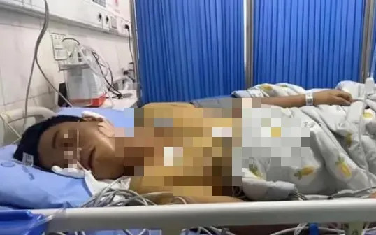 Con bị ù tai thôi mà... và cú sốc của gia đình khi bé trai 14 tuổi được chẩn đoán ung thư giai đoạn tiến triển - Ảnh 3.