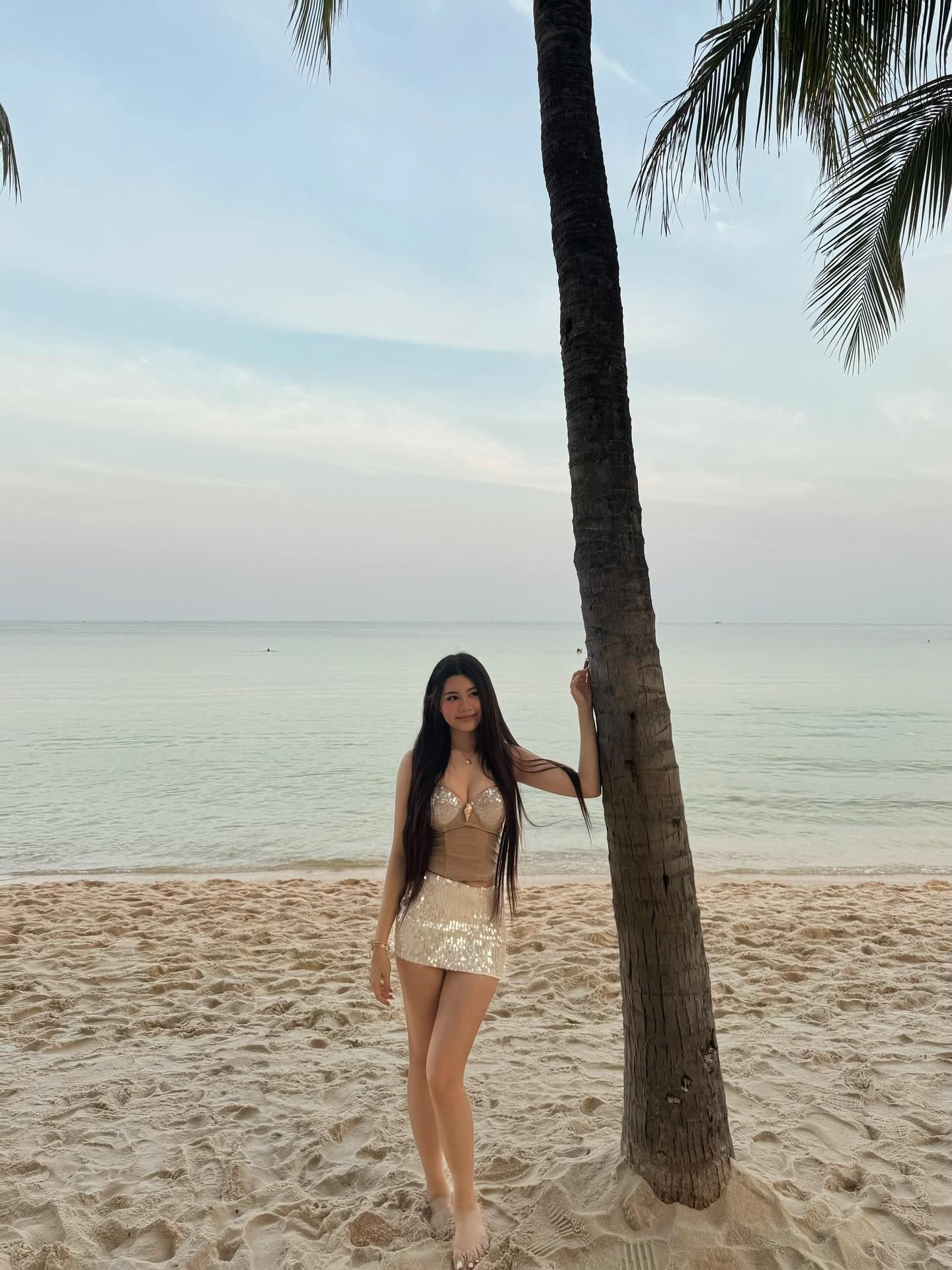 Đôi chân của Hạt Dẻ - Ảnh 2.