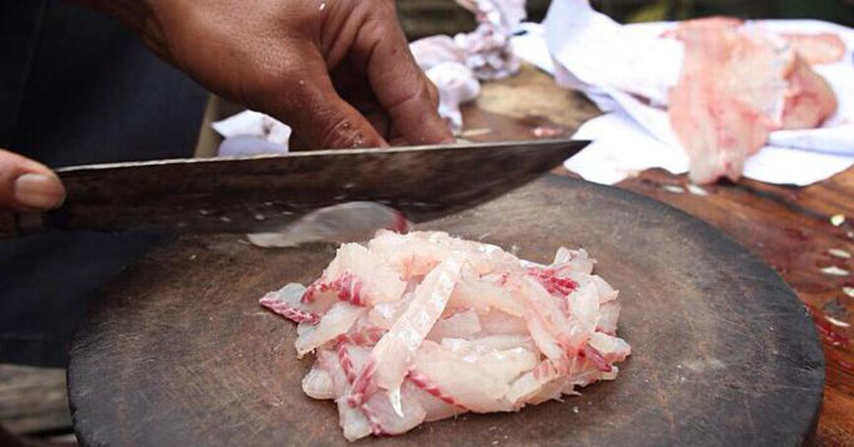 Người đàn ông mắt phải teo nhỏ suốt 12 năm, bác sĩ mổ tủy sống phát hiện “thủ phạm” là thói quen vạn người mê