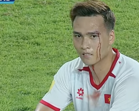 Xót xa khoảnh khắc Bùi Hoàng Việt Anh rách mí mắt, máu chảy ròng ở trận Việt Nam gặp Indonesia