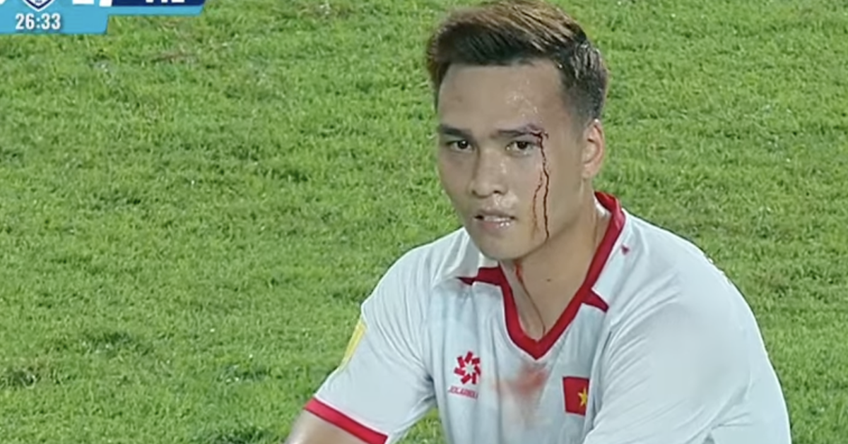 Xót xa khoảnh khắc Bùi Hoàng Việt Anh rách mí mắt, máu chảy ròng ở trận Việt Nam gặp Indonesia