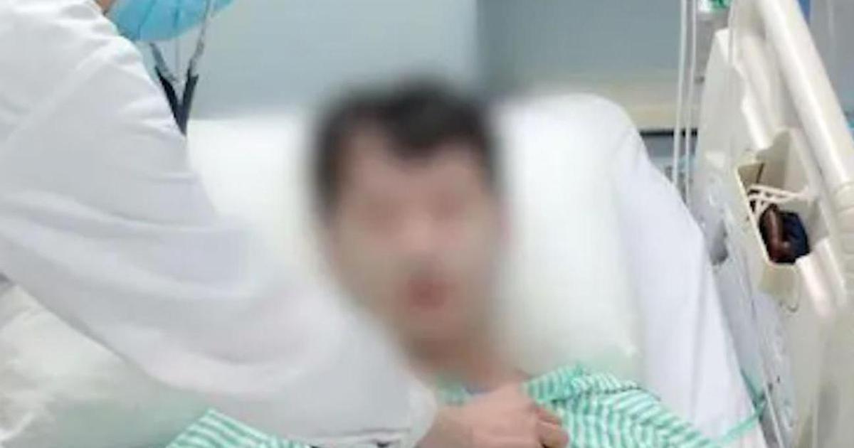 Người đàn ông loét ruột, suýt tử vong vì ăn hải sản theo cách quen thuộc