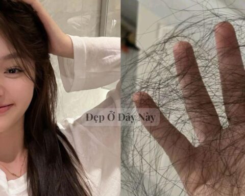 Cứ mỗi lần gội đầu là tóc rụng cả nắm thì cứ áp dụng 5 cách này, hiệu quả đến 80% nếu làm đúng và đều đặn