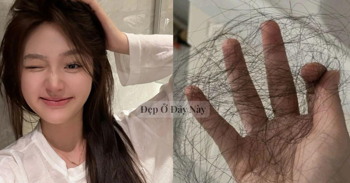 Cứ mỗi lần gội đầu là tóc rụng cả nắm thì cứ áp dụng 5 cách này, hiệu quả đến 80% nếu làm đúng và đều đặn