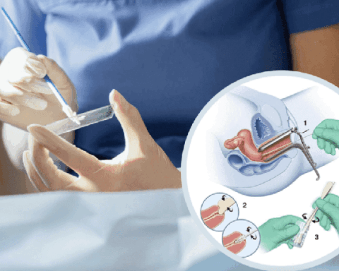 Các xét nghiệm giúp phát hiện sớm ung thư cổ tử cung