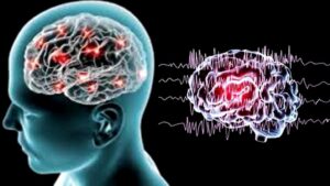 Động kinh ở trẻ em có chữa khỏi được không?