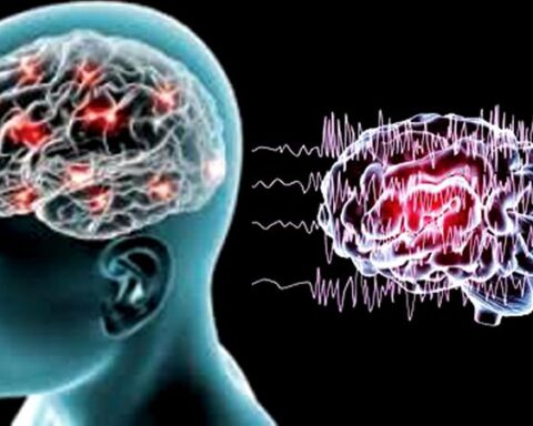 Động kinh ở trẻ em có chữa khỏi được không?