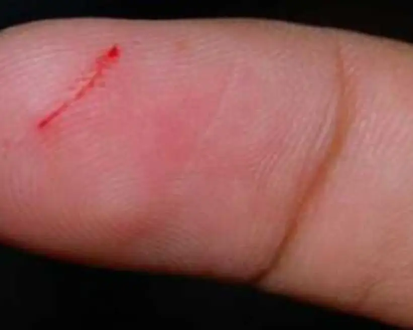 Người đàn ông bất ngờ nhiễm HIV, nguyên nhân được cho là từ một thói quen rất nhiều người có - Ảnh 3.