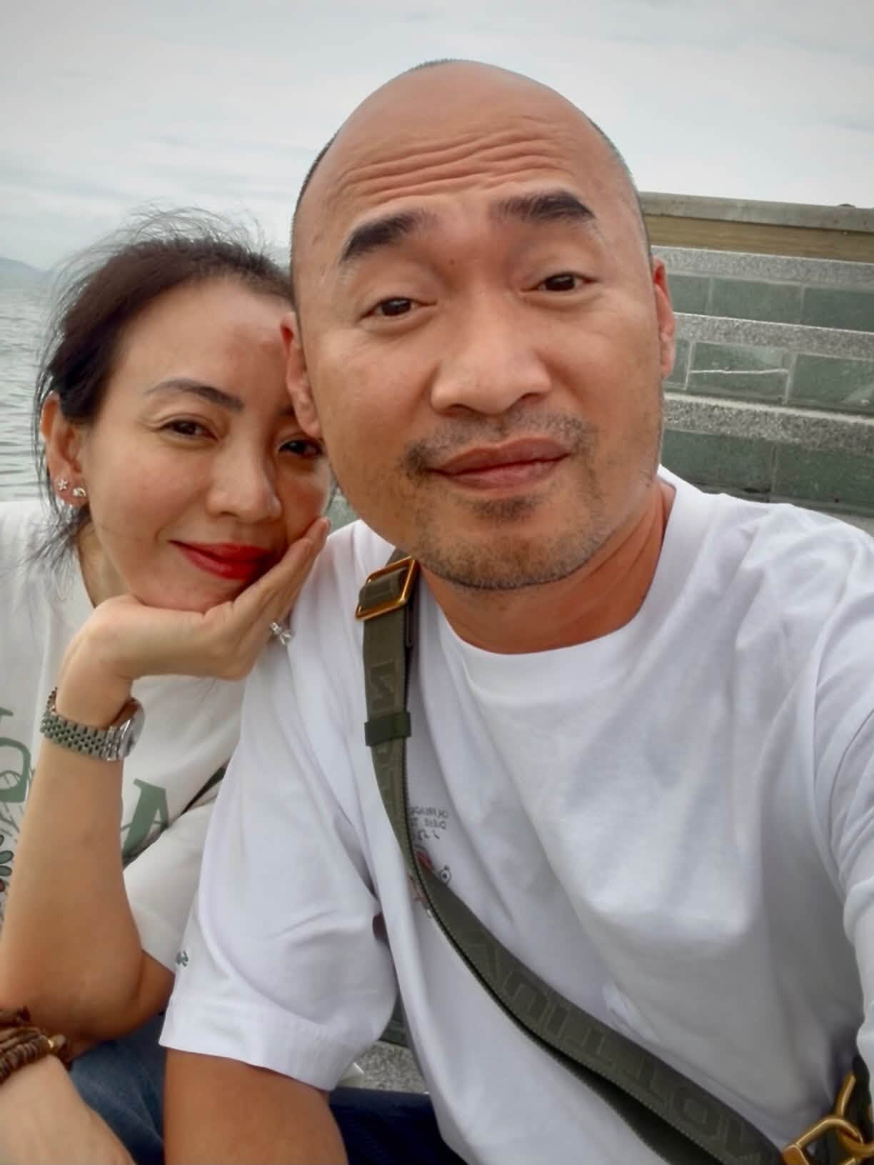 Thu Trang bị thương nghiêm trọng phải khâu 20 mũi ở mặt, Tiến Luật: "Dù thế nào em vẫn đẹp"- Ảnh 1.