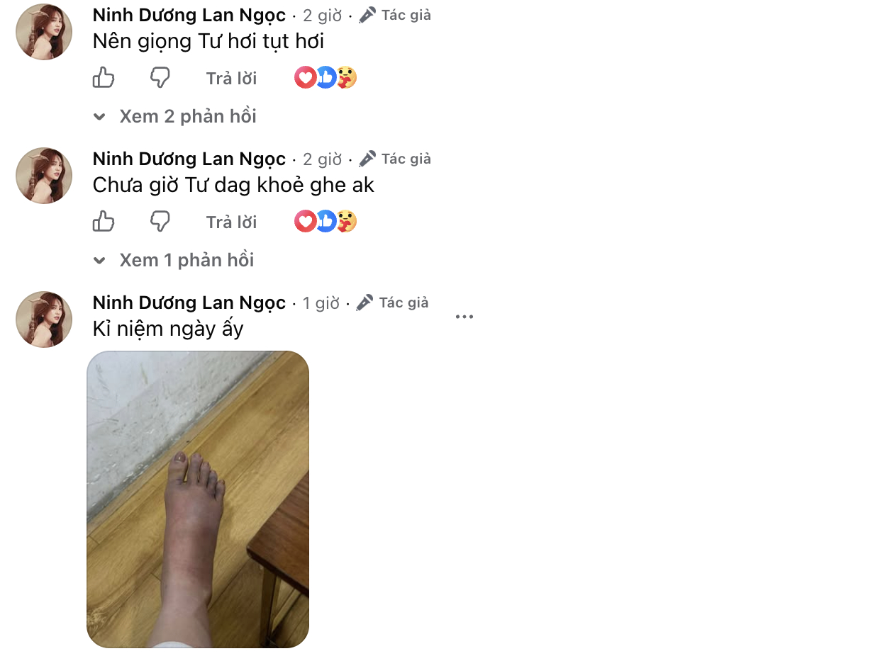 Ninh Dương Lan Ngọc mắc cúm B, chân sưng to gây lo lắng- Ảnh 2.