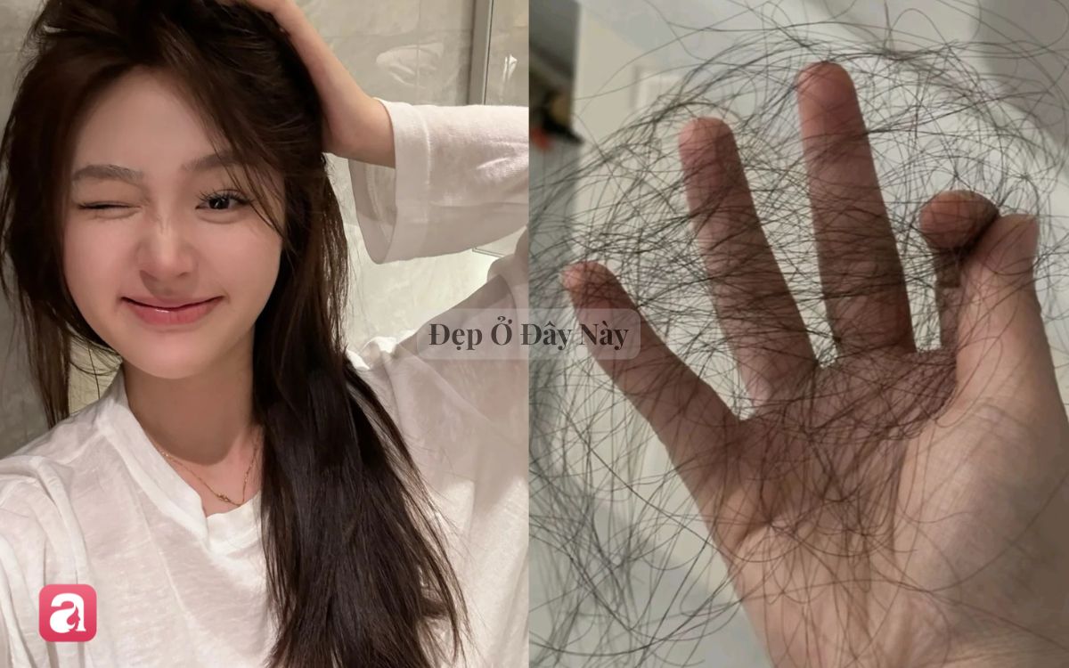 Cứ mỗi lần gội đầu là tóc rụng cả nắm thì cứ áp dụng 5 cách này, hiệu quả đến 80% nếu làm đúng và đều đặn- Ảnh 1.