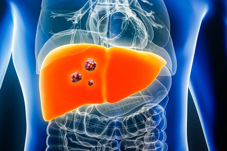 Nam ca sĩ 27 tuổi qua đời vì bệnh gan, bác sĩ nhắc nhở: Thấy 7 điều phải khám trước khi quá muộn! - Ảnh 4.