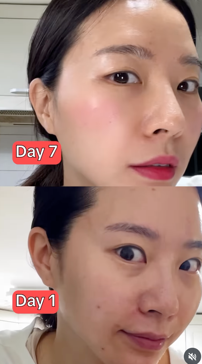 Loại quả bán đầy ngoài chợ: Phụ nữ Việt thi nhau ủ tóc óng mượt, phái đẹp Hàn lại mê làm nước uống "chống già", tiêu mỡ giảm cân- Ảnh 11.