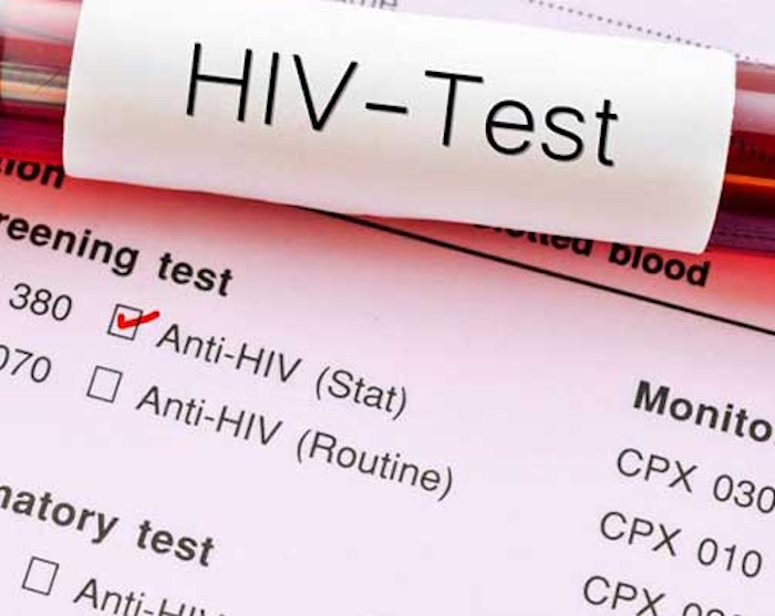 Nữ nghiên cứu sinh tiến sĩ 27 tuổi phát hiện nhiễm HIV, cách mà cô bị lây nhiễm khiến nhiều người "lạnh sống lưng" - Ảnh 1.