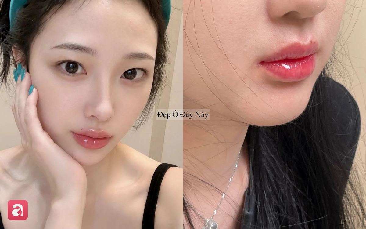 Môi ngày càng thâm mà không biết vì sao? Có thể bạn đang mắc 5 sai lầm này mỗi ngày - Ảnh 1.