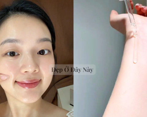 5 serum “made in Vietnam” kiềm dầu, giảm thâm rất hợp với làn da mụn