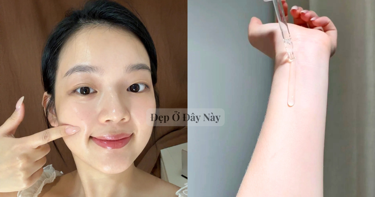 5 serum “made in Vietnam” kiềm dầu, giảm thâm rất hợp với làn da mụn