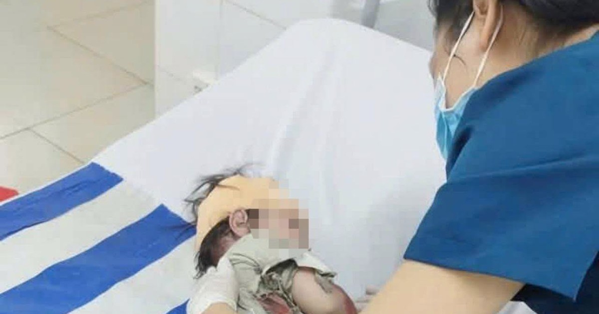 Tình trạng của bé gái 32 tháng tuổi sống sót trong vụ tai nạn khiến 3 người tử vong ở Đồng Nai