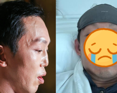 Nam thần màn ảnh vỡ nát mặt mũi sau vụ bị xe tông, tốn 13 tỷ sửa dung mạo bố mẹ vẫn nhận không ra
