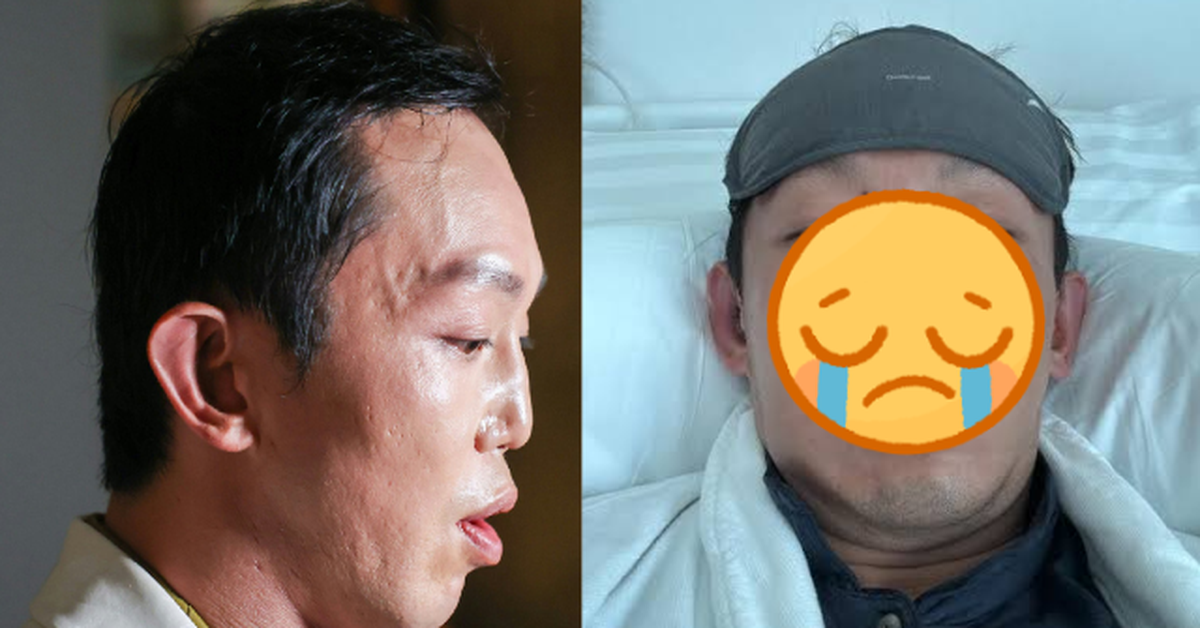 Nam thần màn ảnh vỡ nát mặt mũi sau vụ bị xe tông, tốn 13 tỷ sửa dung mạo bố mẹ vẫn nhận không ra