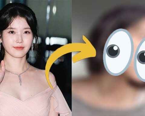 IU tranh thủ “dao kéo” nâng cấp nhan sắc sau khi chia tay Lee Jong Suk?