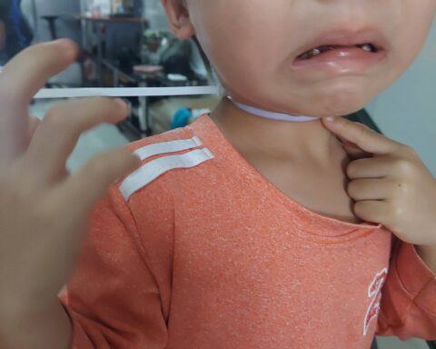Mẹ trẻ chia sẻ phen “đứng tim” khi thấy con trai bị dây rút nhựa siết chặt cổ