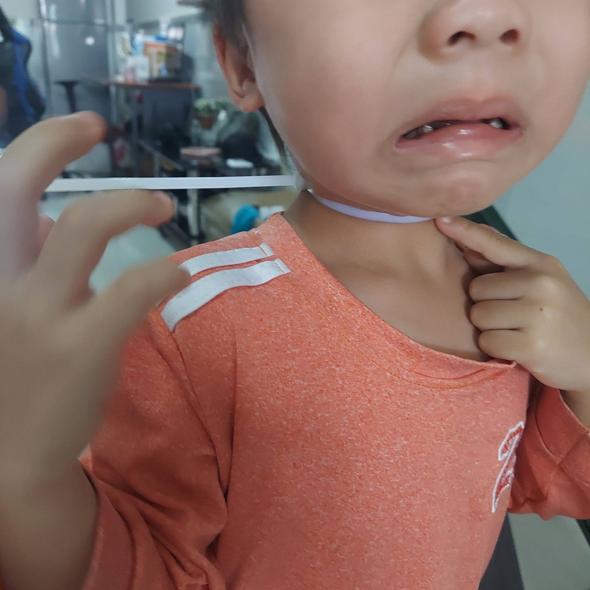 Mẹ trẻ chia sẻ phen “đứng tim” khi thấy con trai bị dây rút nhựa siết chặt cổ