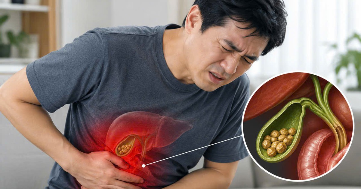 Bác sĩ chỉ 4 dấu hiệu cảnh báo sỏi mật, một dấu hiệu dễ nhận thấy sau bữa ăn
