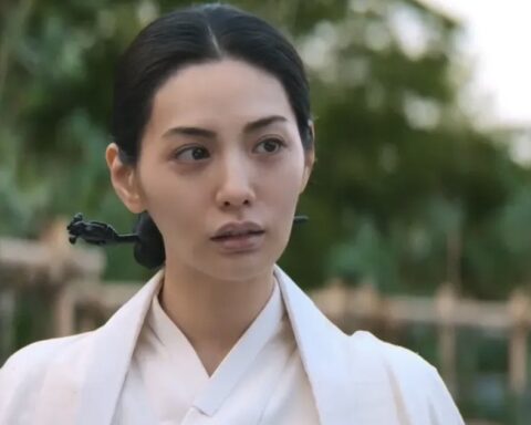 Mỹ nhân đẹp nhất thế giới vướng tranh cãi vì tiêm filler lố